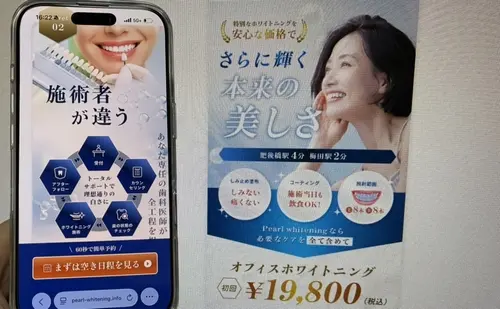 パールホワイトニング