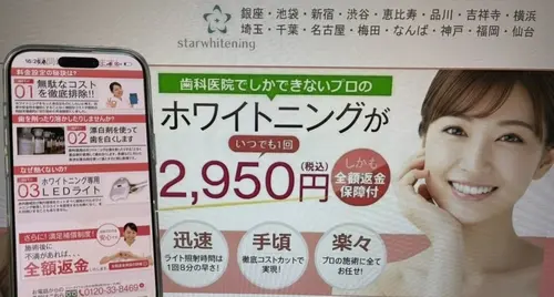 スターホワイトニング