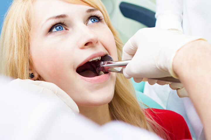 歯列矯正で抜歯は必須？抜歯をすることのメリット・デメリットや注意点を紹介の画像