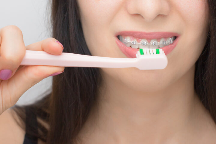 歯列矯正中の正しい歯磨き方法を紹介！歯磨きのポイントと虫歯にならないためのコツの画像
