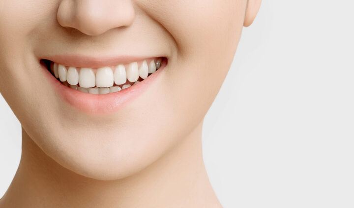 前歯だけの部分矯正でも劇的に変化する！気になる歯だけ矯正する治療法とメリットとは？の画像