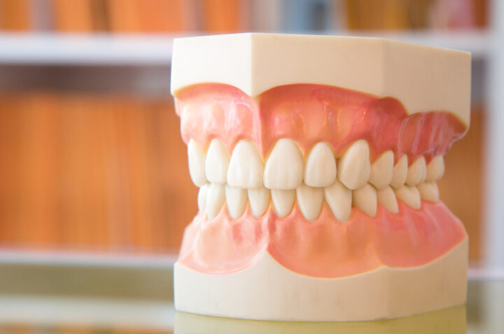 ガミースマイルの治療方法はあるの？歯列矯正での治し方やその他方法まで全てを紹介！の画像