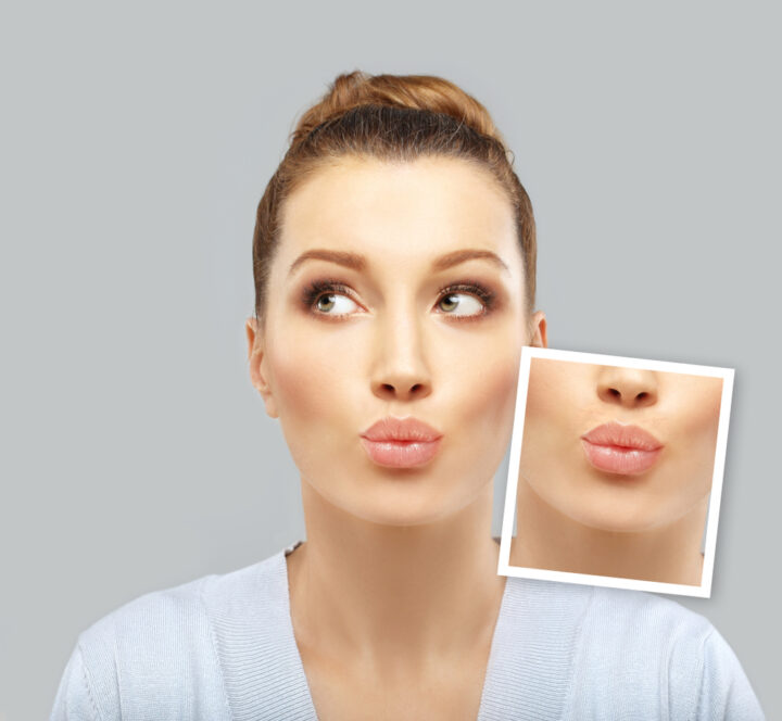 歯列矯正をすると人中は伸びたり縮んだりする？顔や口元の印象を左右する変化と原因の画像