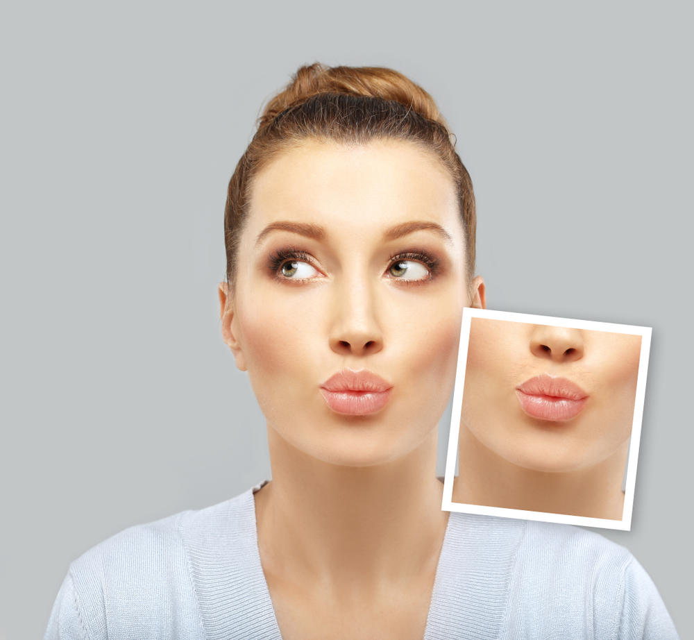 歯列矯正をすると人中は伸びたり縮んだりする？顔や口元の印象を左右する変化と原因